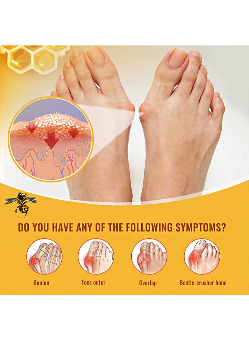 Sumifun 2 Pieces Of Bunion Pain Relief Ointment，Topical Arthritis Pain Relief Cream For Hallux Valgus And Swelling Of Toes  - Image 2