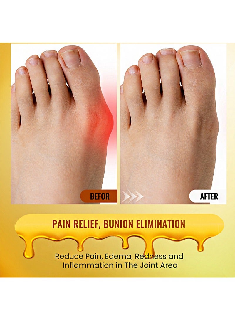 Sumifun 2 Pieces Of Bunion Pain Relief Ointment，Topical Arthritis Pain Relief Cream For Hallux Valgus And Swelling Of Toes  - Image 5