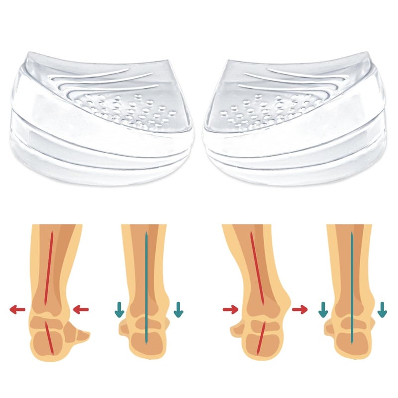 Skyfoot Skyfoot 3 Layers Adjustable Heel Wedge Inserts for Supination Pronation Correction Adhesive Medial Lateral Heel Insoles for Bow Legs Knee Pain Foot Alignment L W 711 M 710 Crystal