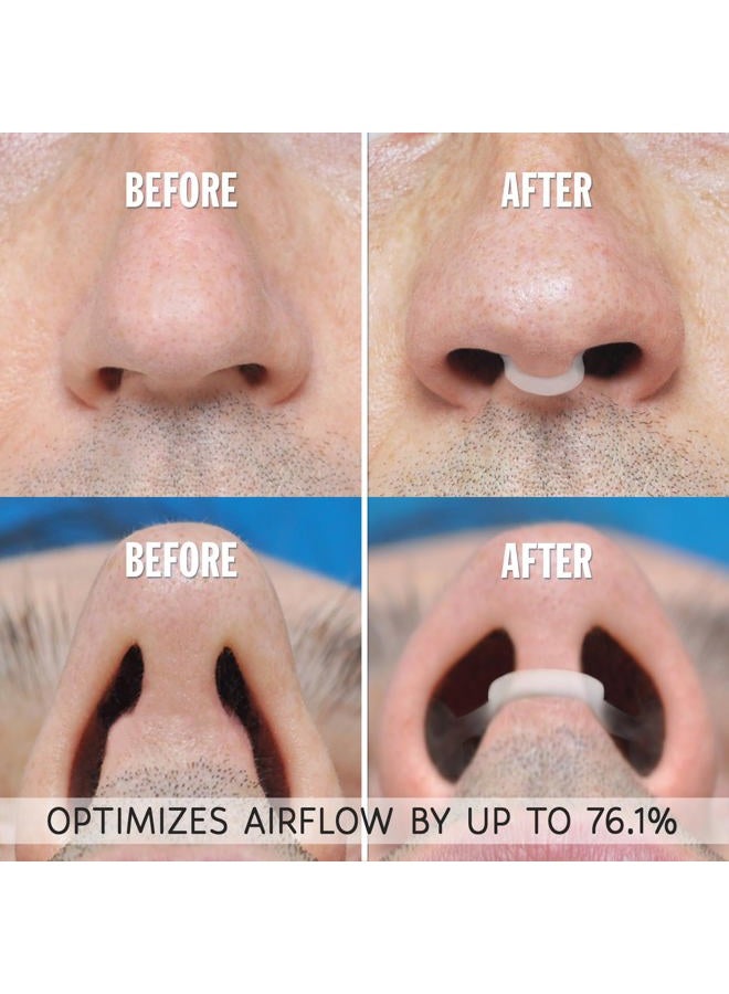 airmax موسع أنفي لتحسين النوم - جهاز طبيعي ومريح مضاد للشخير، حل للشخير لزيادة تدفق الهواء وسهولة التنفس - عبوة تجريبية بحجمين (صغير ومتوسط - شفاف) - Image 4
