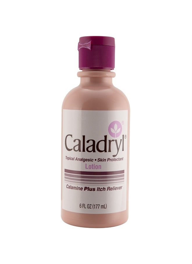 Caladryl لوشن كالامين من كالادريل، واقي للبشرة بالإضافة إلى تخفيف الحكة، 6 أونصة سائلة  - Image 1