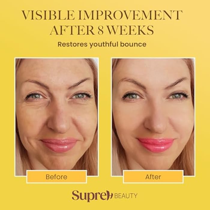 SupreH Bee Venom Wrinkle Cream: Wrinkle Cream for Women with Bee Venom Hyaluronic acid Niacinamide and Peptides - for fine lines and face firming 50 - Image 4