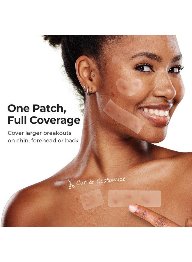 تي كيه تي كيه رقعة كبيرة لعلاج حب الشباب من تي كي تي كيه للوجه، رقعة كبيرة لعلاج حب الشباب، 60 × 20 مم، ضمادات كبيرة من الهيدروكولويد للجسم والجبهة والذقن والرقبة، رقعة هيدروكولويد (شريط، محدد، نقط، 5 مقاسات، 96 قطعة) - Image 3