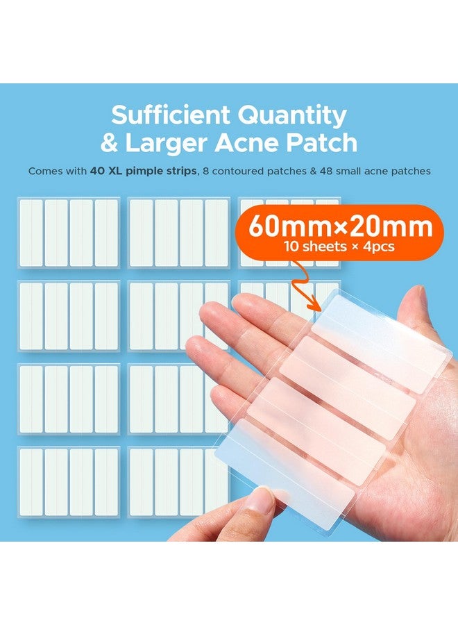 تي كيه تي كيه رقعة كبيرة لعلاج حب الشباب من تي كي تي كيه للوجه، رقعة كبيرة لعلاج حب الشباب، 60 × 20 مم، ضمادات كبيرة من الهيدروكولويد للجسم والجبهة والذقن والرقبة، رقعة هيدروكولويد (شريط، محدد، نقط، 5 مقاسات، 96 قطعة) - Image 2