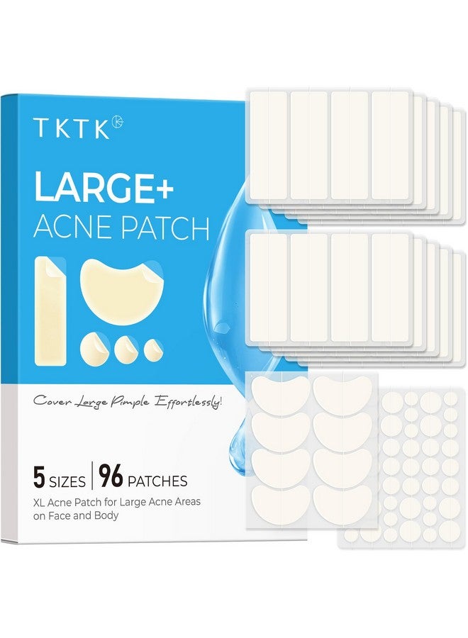 تي كيه تي كيه رقعة كبيرة لعلاج حب الشباب من تي كي تي كيه للوجه، رقعة كبيرة لعلاج حب الشباب، 60 × 20 مم، ضمادات كبيرة من الهيدروكولويد للجسم والجبهة والذقن والرقبة، رقعة هيدروكولويد (شريط، محدد، نقط، 5 مقاسات، 96 قطعة) - Image 1