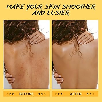 POP MODERN.C Turmeric and Vitamin C Body Scrub Exfoliating Scrub Remove Dead Skin Improve Dark Spots Acne Natural Deep Cleansing Exfoliator for Body Butt Bikini Area Body Care for Men Women with Loofah - Image 4