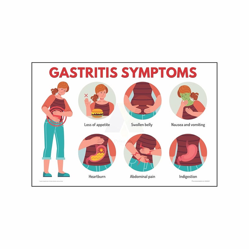 Anne Print Solutions Anne Print Solutions Gastritis symptoms chart Posters Size 13 X 19 Inch For Hospital Posters Nursing Home Posters Clinic Posters Pack Of 1 Pcs Multicolor