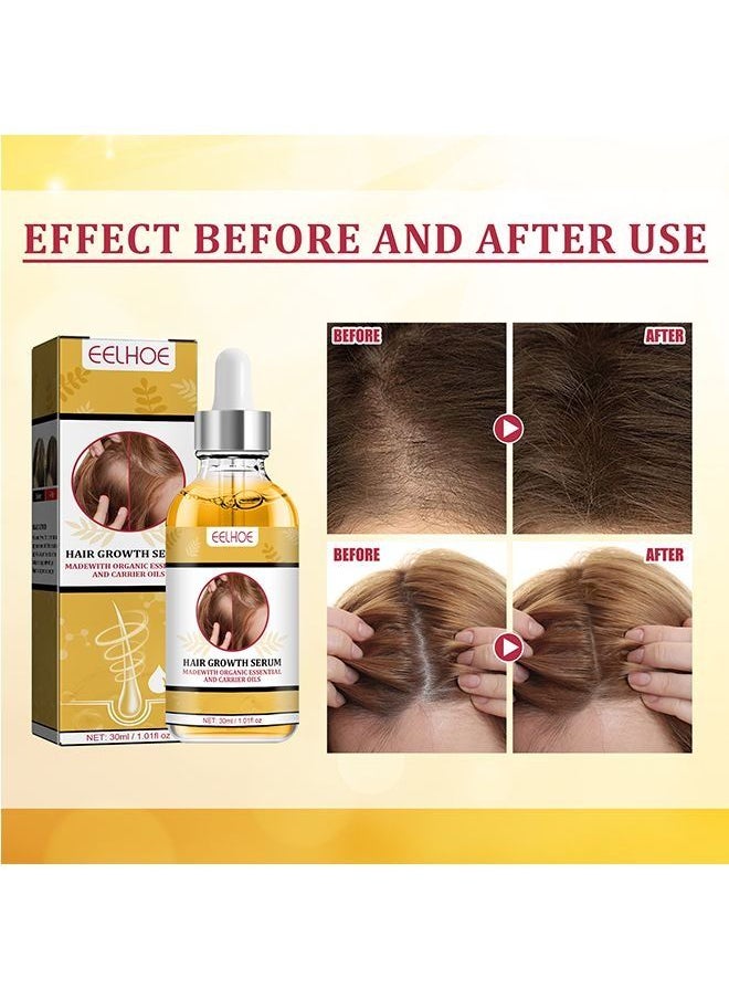EELHOE - Garlic Hair Nutrient Solution To Prevent And Nourish Scalp Hair Growth Solution 30ml - Image 1