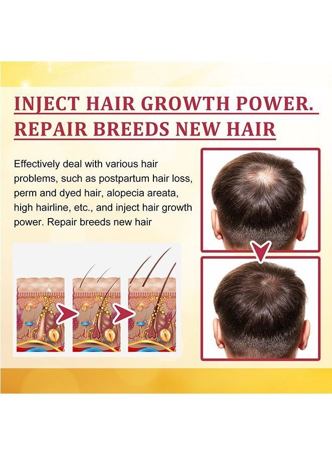 EELHOE - Garlic Hair Nutrient Solution To Prevent And Nourish Scalp Hair Growth Solution 30ml - Image 1