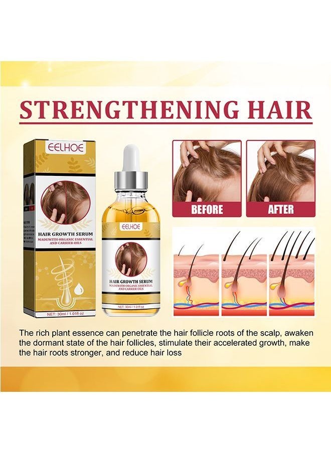 EELHOE - Garlic Hair Nutrient Solution To Prevent And Nourish Scalp Hair Growth Solution 30ml - Image 1
