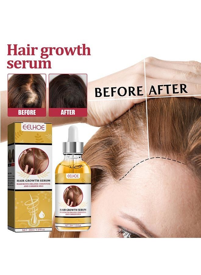 EELHOE - Garlic Hair Nutrient Solution To Prevent And Nourish Scalp Hair Growth Solution 30ml - Image 1
