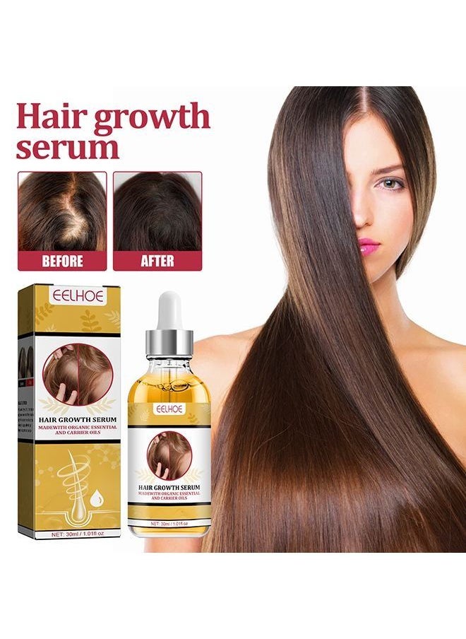 EELHOE - Garlic Hair Nutrient Solution To Prevent And Nourish Scalp Hair Growth Solution 30ml - Image 1