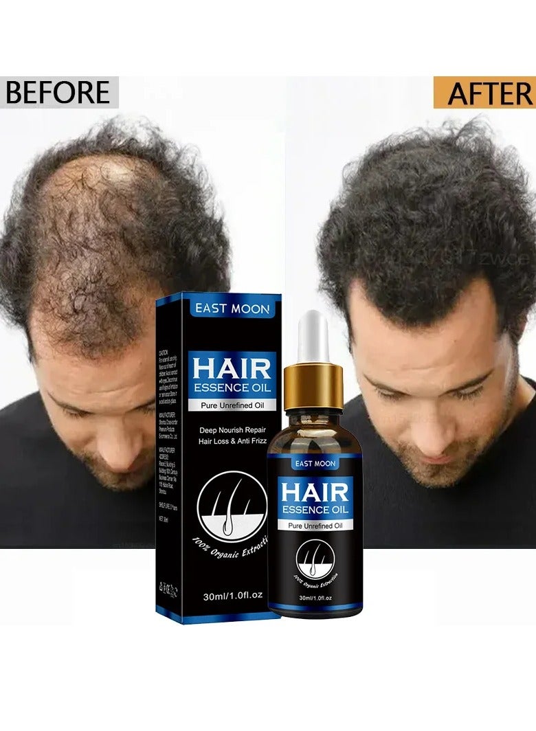 East Moon مصل نمو الشعر للرجال، زيت عطري لنمو الشعر السريع لمدة 7 أيام، مصل فعال لتكثيف الشعر من مستخلصات نباتية، علاج غير مهيج لتساقط الشعر لإعادة نمو الشعر بشكل أكثر كثافة - Image 1