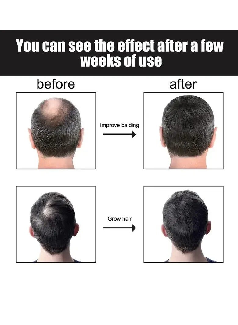 East Moon مصل نمو الشعر للرجال، زيت عطري لنمو الشعر السريع لمدة 7 أيام، مصل فعال لتكثيف الشعر من مستخلصات نباتية، علاج غير مهيج لتساقط الشعر لإعادة نمو الشعر بشكل أكثر كثافة - Image 4