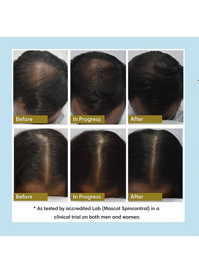 THE EARTH COLLECTIVE - Hair Density Tonic, Reduce Hair Fall And Promote Hair Growth, For Men And Women, 89% Plant Derived, 100 Ml. - Image 1