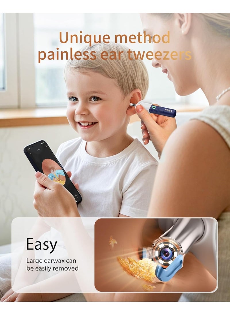 Bebird Ear Wax Removal Tool with HD Camera Kit | Wireless Otoscope Ear Cleaning Kit with Flexible Visual Endoscope, High-Definition Ear Camera, Painless Earwax Remover Tweezers & 4 Safe Spoon Tips | Portable Ear Cleaner for Adults, Kids & Pets, Real-Time WiFi Ear Canal Inspection, Home Endoscope for Ears, Nose, Throat & Mouth Health Check - Image 3