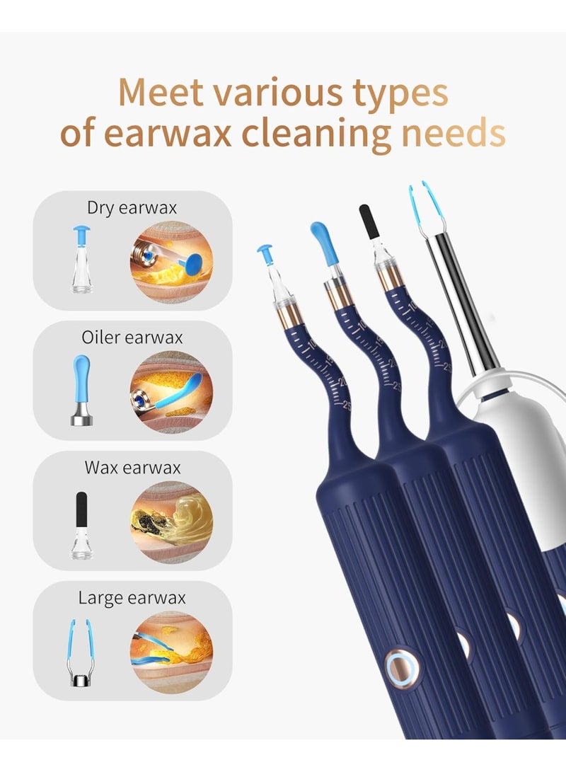 Bebird Ear Wax Removal Tool with HD Camera Kit | Wireless Otoscope Ear Cleaning Kit with Flexible Visual Endoscope, High-Definition Ear Camera, Painless Earwax Remover Tweezers & 4 Safe Spoon Tips | Portable Ear Cleaner for Adults, Kids & Pets, Real-Time WiFi Ear Canal Inspection, Home Endoscope for Ears, Nose, Throat & Mouth Health Check - Image 4