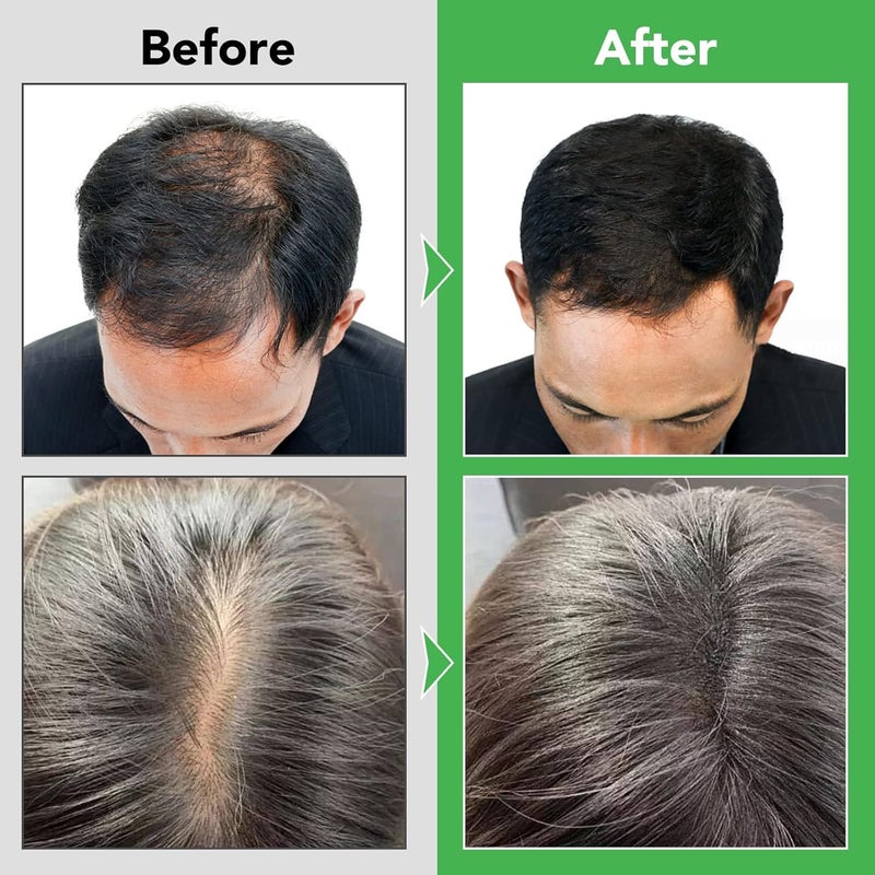 Rosemary Shampoo for Hair Growth,Rosemary Mint Strengthening Shampoo,Shampoo for Women Hair Loss And Thinning Hair With Biotin,Smooth Nourishes Shampoo for Men Women 10 Fl Oz - Image 5