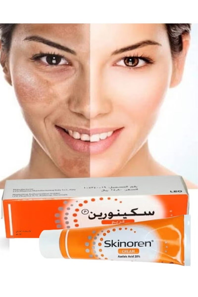 Skinoren Original Freshness Cream to Lighten the Skin, Treat pimples, Melasma and Acne 30g - Image 3