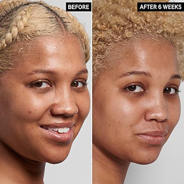 The INKEY List 10% Niacinamide Serum, Lightweight Oil Control Serum Helps with Blemishes and Appearance of Redness, Hydrating 1% Hyaluronic Acid 30ml, 1 fl oz - Image 2