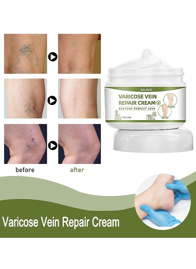 EELHOE - Varicose Veins Repair Cream, Spider Veins Repair Cream, Strengthen Capillary Health, Varicose Vein Treatment Cream For Legs, Improve Blood Circulation, Tired And Heavy Legs 50G - Image 1
