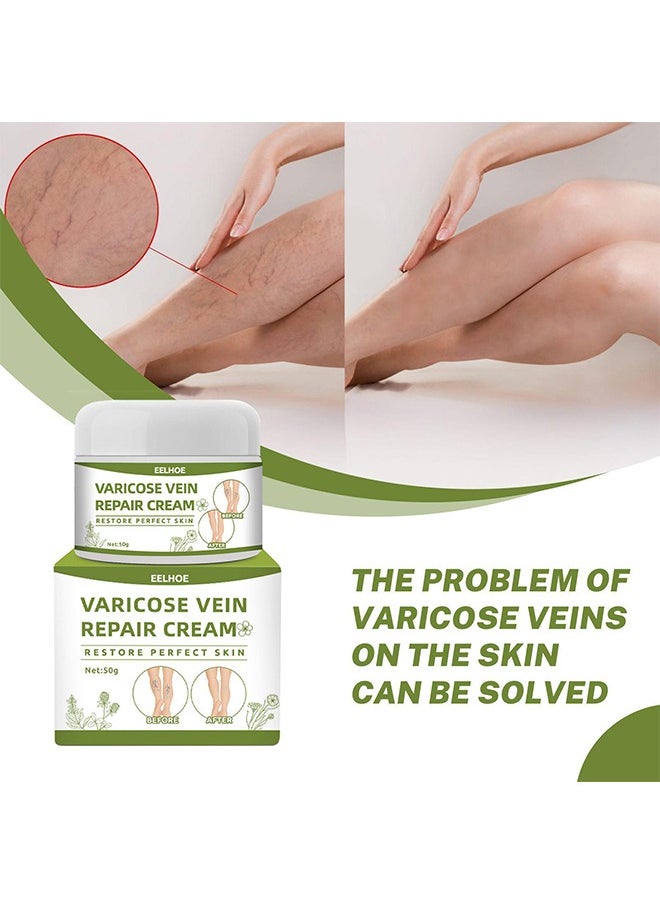 EELHOE - Varicose Veins Repair Cream, Spider Veins Repair Cream, Strengthen Capillary Health, Varicose Vein Treatment Cream For Legs, Improve Blood Circulation, Tired And Heavy Legs 50G - Image 1