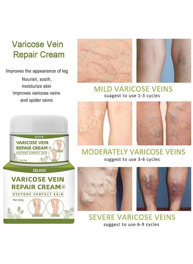 EELHOE - Varicose Veins Repair Cream, Spider Veins Repair Cream, Strengthen Capillary Health, Varicose Vein Treatment Cream For Legs, Improve Blood Circulation, Tired And Heavy Legs 50G - Image 1