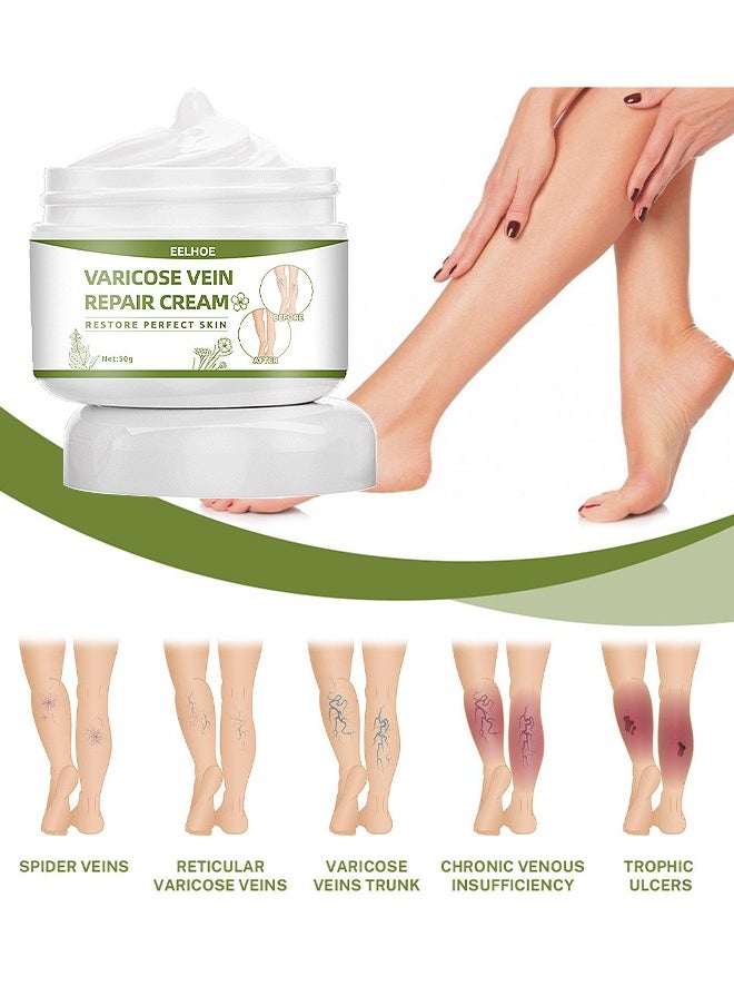 EELHOE - Varicose Veins Repair Cream, Spider Veins Repair Cream, Strengthen Capillary Health, Varicose Vein Treatment Cream For Legs, Improve Blood Circulation, Tired And Heavy Legs 50G - Image 1