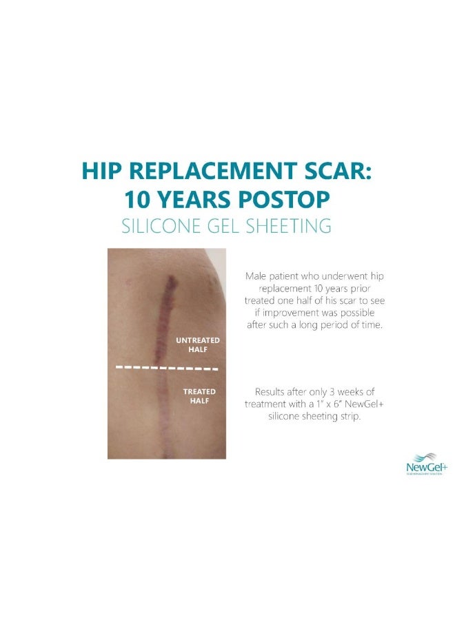 NewGel+ ورقة شفافة 12.7 سم 15.2 سم - Image 3