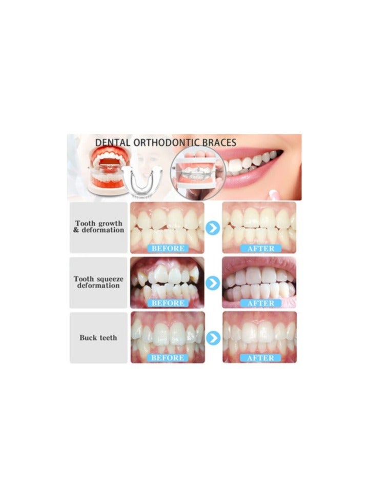 A.M Multifunctional Invisible Teeth Braces. Three Phases, Custom Food Grade, Medical Material, Dental Aligner. - Image 3