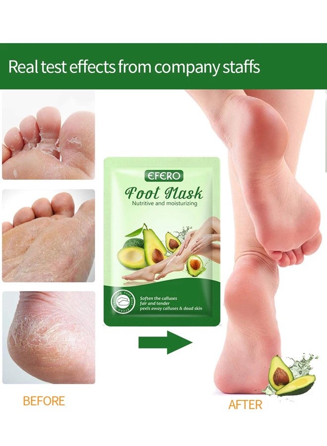efero Foot Peeling and Exfoliating Mask, Dead Skin Removing Sock - Avocado - Image 5