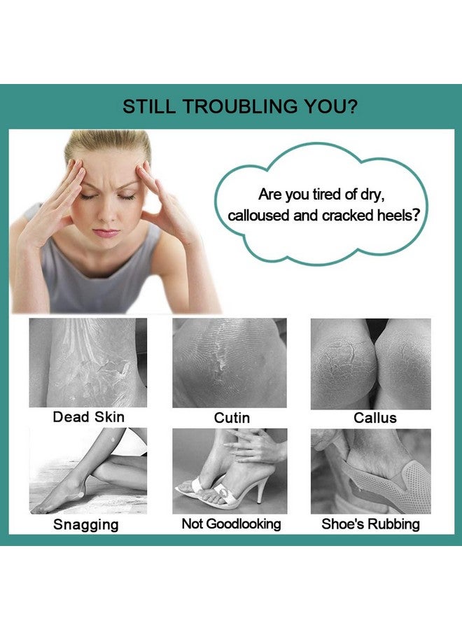 CAREHOOD Foot File Callus Remover Multi Purpose 4 In 1 Feet Pedicure Tools With Foot Scrubber Pumice Stone Foot Rasp And Sand Paper For Home Foot Care (Red Pedicure Foot File) - Image 3