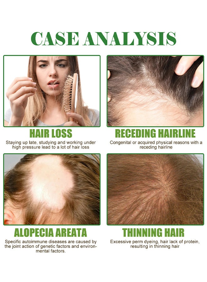 إيلهو روزماري النعناع فروة الرأس وزيت تقوية الشعر ، وقف تساقط الشعر ، علاج ترقق زيت نمو الشعر للنساء والرجال 60 مل - Image 4