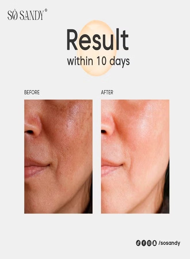 So Sandy SHINE AND WHITE FACE SERUM Tranexamic Acid - Bee Venom With Whitening Effect 30ml - Image 5