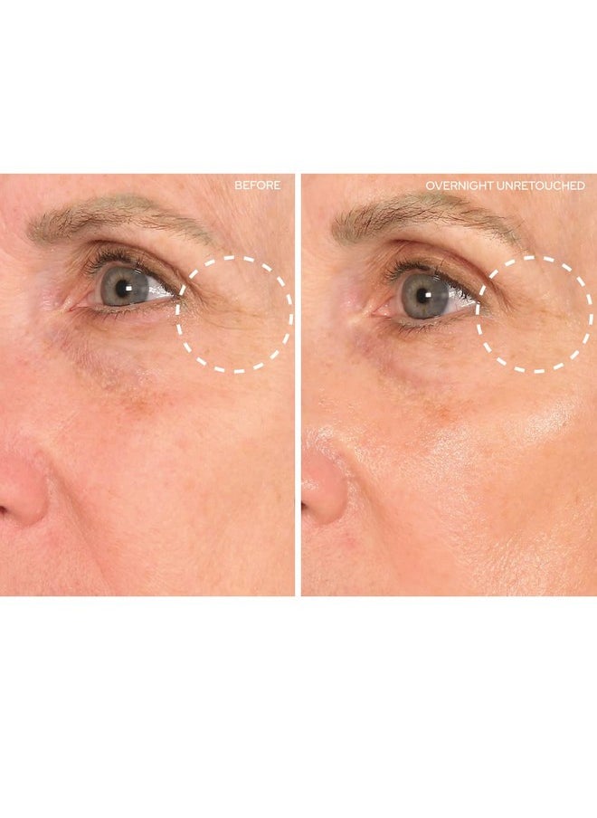 Sio - SiO Beauty SuperLift Forehead, Eye, & Lip Anti-Wrinkle Silicone Patches - Reduce Brow, Smile, and Under Eye Wrinkles Overnight - Image 1