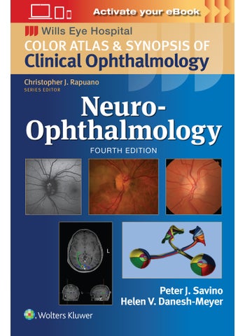 Neuro-Ophthalmology: Print + eBook with Multimedia - pzsku/ZA4DE99FB478A11BD8A98Z/45/_/1734598732/e74a03e9-982a-4b16-8b3d-310f28c9fead