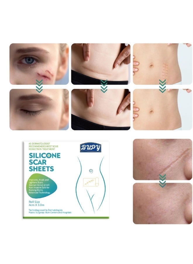 BUPY Medical Grade Silicone Scar Film, Large Capacity Silicone Scar Tape, Suitable for hypertrophic, Acne, Scar Tissue, Injury and Burn Scars, as Well as Pregnancy Scar Types. (1.6in×60in) - Image 2