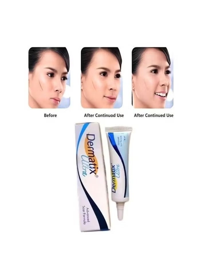 Dermatix Advanced Scar Gel 15g For Cosmetic Improvement of Scars, Fast Drying and Unique Silicone Gel Formulation, Used For Treatment of Keloids, Surgical and Hypertrophic Scars, Suitable For Sensitive Skin - Image 2