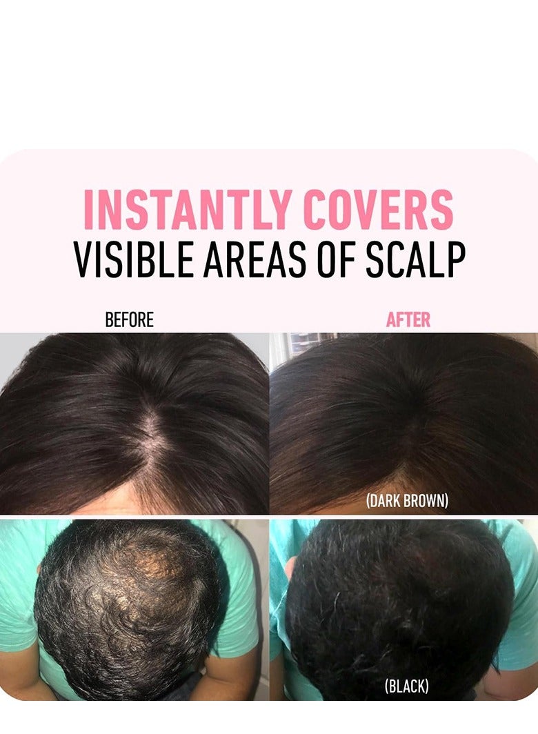 VERONNI Enhance Hairline Powder, Hairbear Hair Filler,Hairline Shadow Powder,Hairline Powder Instantly Conceals,Instant Volume&scalp Coverage for Thinning Hair,Fast & Full Care, 100% Water Sweat Resistant - Image 3