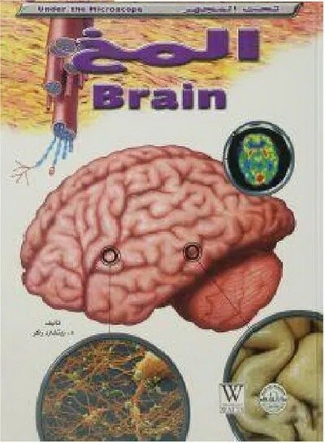 The brain - under the microscope 