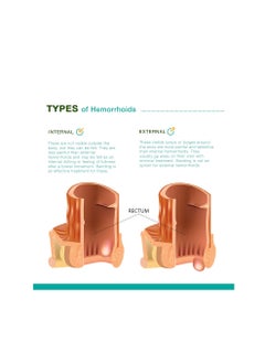 REEJOYS Hemorrhoid Cream Treatment 0.9oz Pack of 2  - Image 2