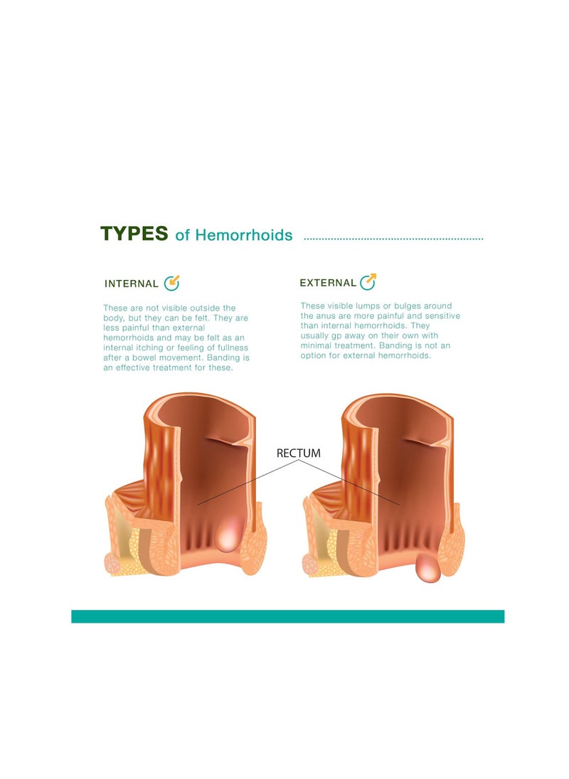 REEJOYS Hemorrhoid Cream Treatment 0.9oz Pack of 2  - Image 2