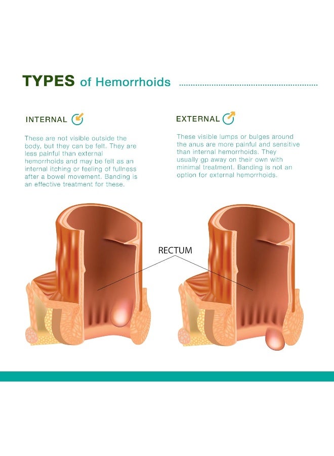 REEJOYS Hemorrhoid Cream, Hemorrhoid Treatment (0.9 oz/Pack) 2 Packs - Image 3