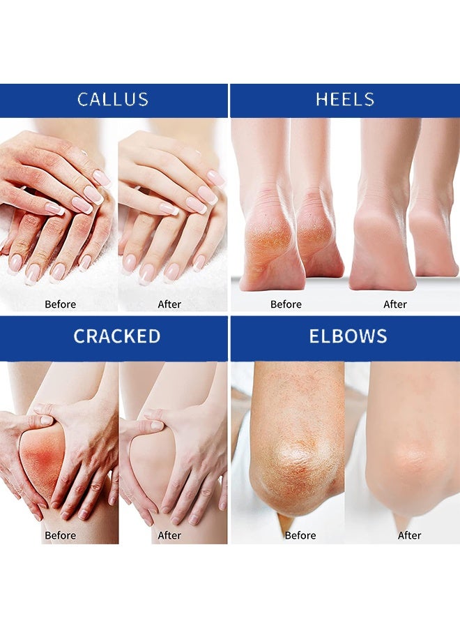 BARUBT 60% Urea Cream + 2% Saliculic Acid Foot Cream - Urea Cream for Feet Moisturizer for Dry Cracked Feet Knees Elbows Hands - Heel Balm Stick Aloe Vera, Beeswax, Urea Foot Cream Smoothing Skin 40g - Image 5