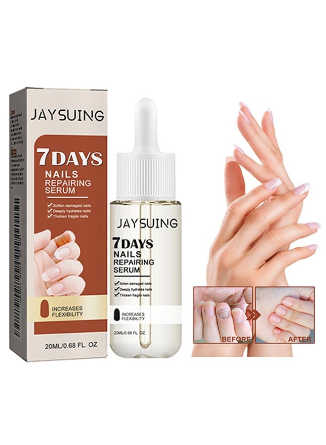 Jaysuing 7 Days Nails Repairing Serum 20ml, Anti-Fungal/Nourishing/Strengthening Formula, Nail Growth & Strengthener Oil for Damaged Nails, Improves Nail Health - Image 1
