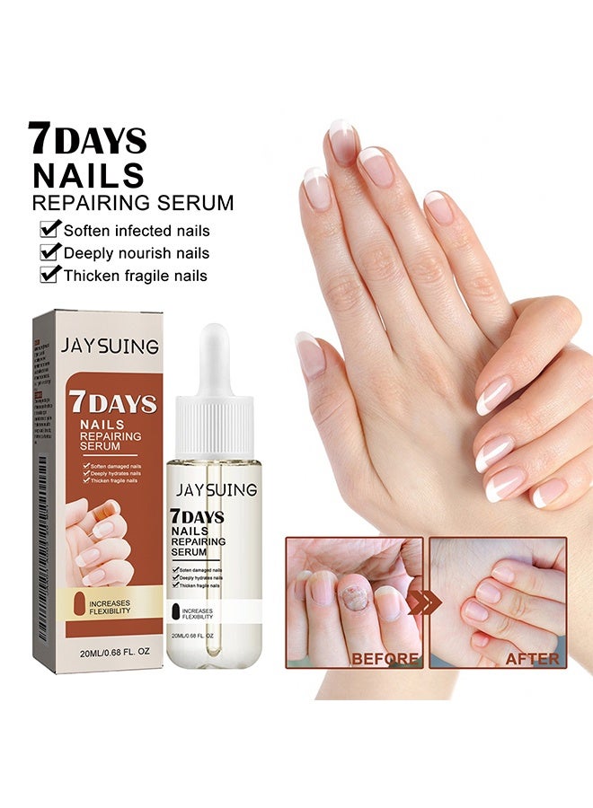 Jaysuing 7 Days Nails Repairing Serum 20ml, Anti-Fungal/Nourishing/Strengthening Formula, Nail Growth & Strengthener Oil for Damaged Nails, Improves Nail Health - Image 2