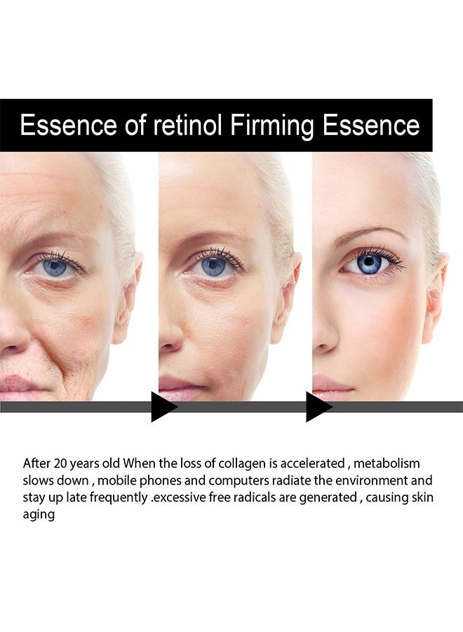 OUHOE Anti Aging & firming Retinol Serum , Vitamine E & Antioxidants Hyaluronic Acid Anti-Aging Serum, Reduces Wrinkles, Fine Lines, Age Spots, Sun Spots, Anti Wrinkle Facial Serum 30ml - Image 5