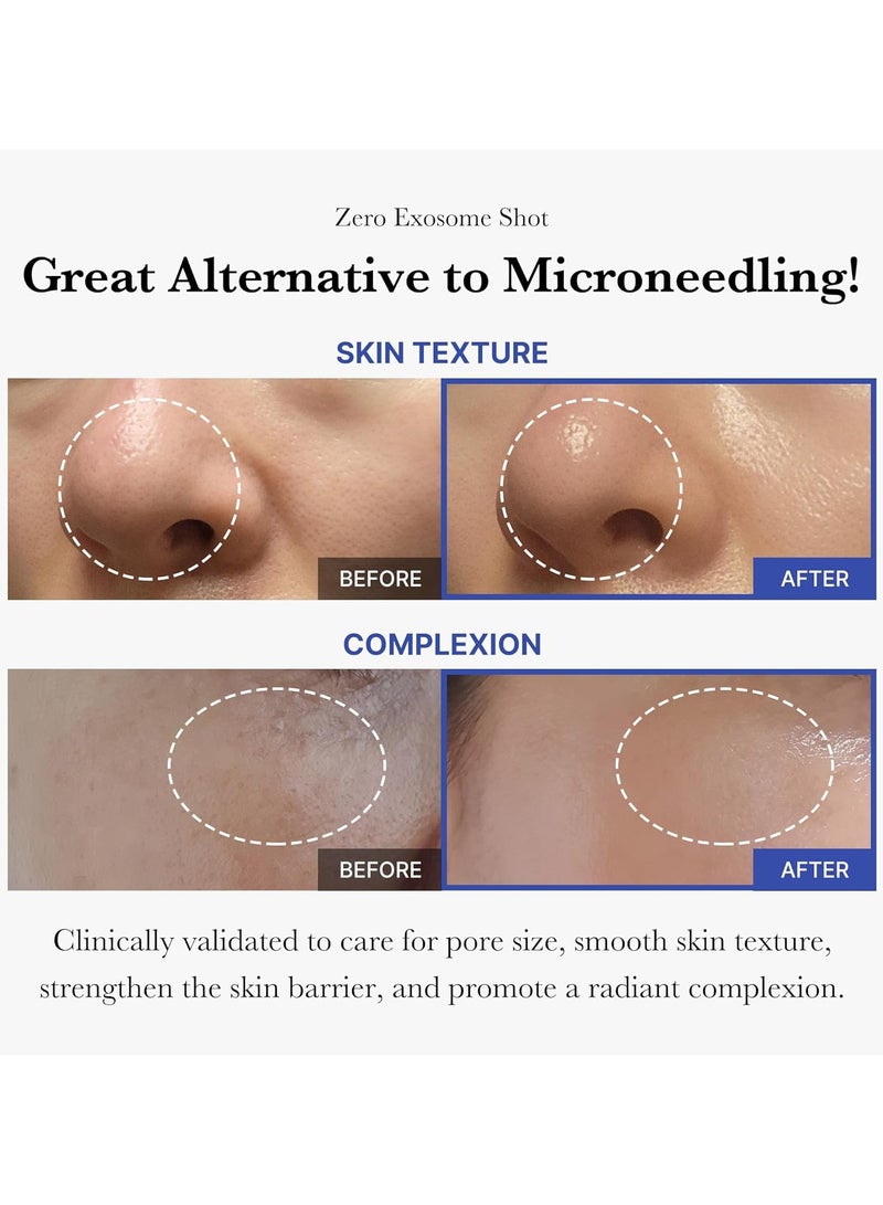 ميديكيوب سيروم الوجه زيرو اكسوسوم شوت 7500 جزء في المليون من ميديكوب، سيروم سائل معزز للبشرة| اكسوسوم بأحماض AHA+BHA+PHA| لعلاج بالمسام وخلايا الجلد الميتة وملمس البشرة| العناية بالبشرة الكورية، 30 مل - Image 2