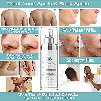 db مصحح بقع داكنة db Bright Skin للوجه والجسم 30 مل يقلل من تغير اللون الناتج عن حب الشباب وأضرار الشمس والشعر الناشئ والمزيد تركيبة غير محددة للجنس للرجال والنساء - Image 2