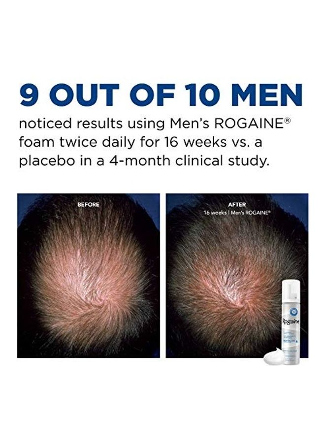 Rogaine Hair Loss And Regrowth Minoxidil Foam Clear 60grams - Image 3